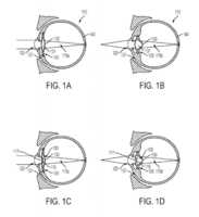 Après les diabétiques, Google s’intéresse aux myopes