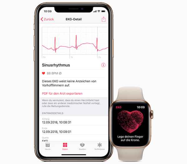 Apple active en Europe l’électrocardiogramme de sa Watch